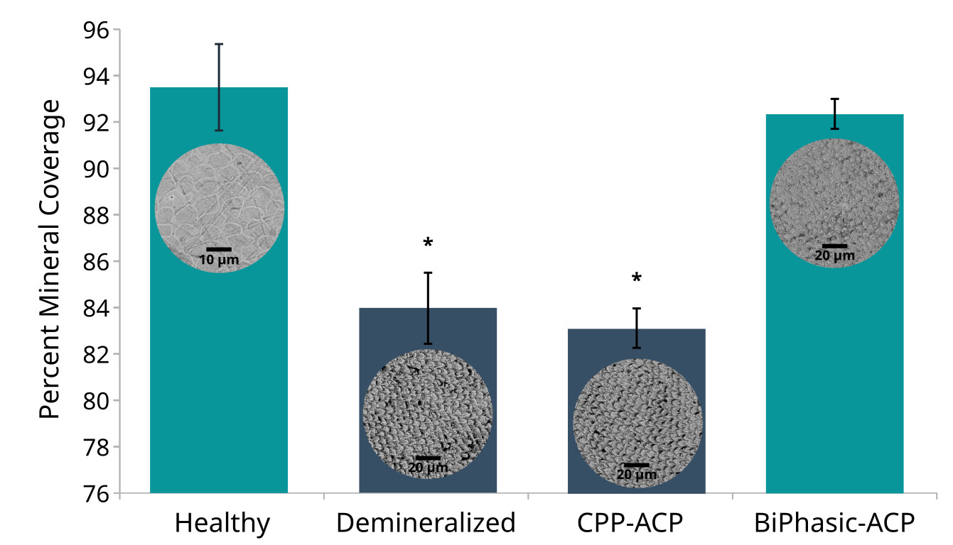 SEM analysis of enamel remineralized by BiPhasic-ACP